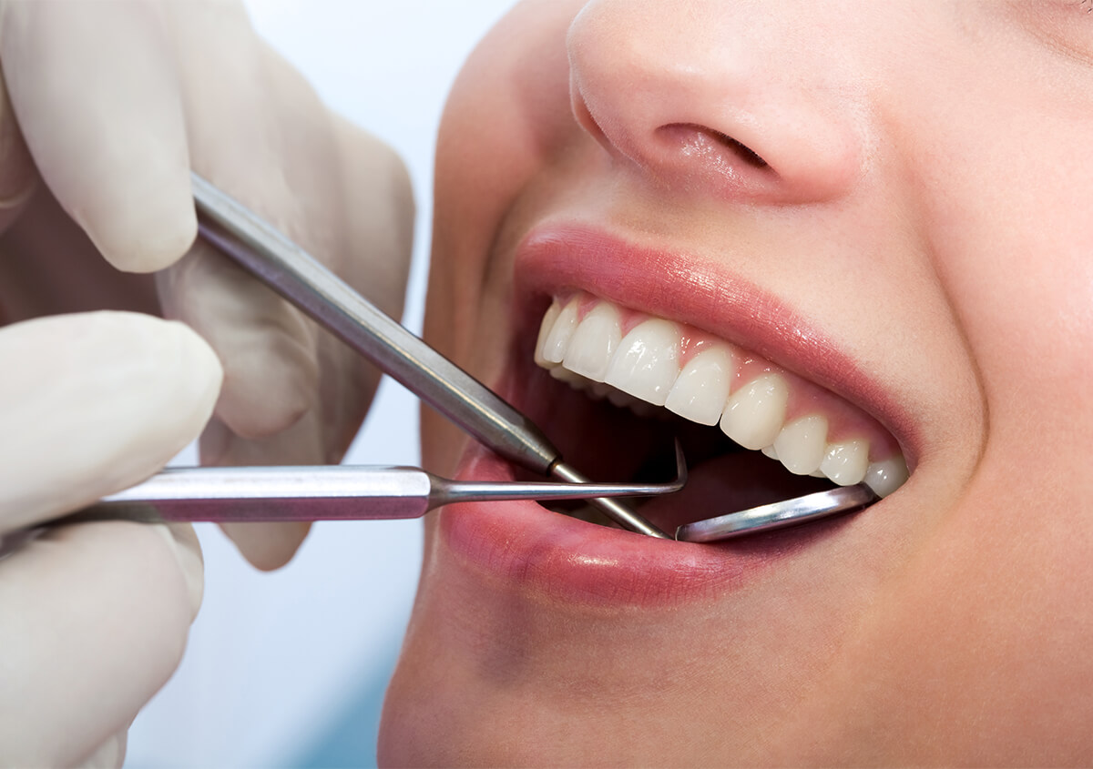 Preventive Dental Options in Novi MI Area